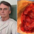 Bolsonaro posta foto das próprias tripas e choca redes sociais